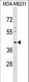 Potassium Voltage-Gated Channel Subfamily J Member 15 antibody, LS-C165429, Lifespan Biosciences, Western Blot image 