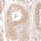Dicer 1, Ribonuclease III antibody, NBP1-85213, Novus Biologicals, Immunohistochemistry paraffin image 