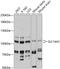 Solute Carrier Family 14 Member 2 antibody, 14-850, ProSci, Western Blot image 