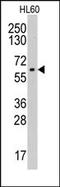 Cytochrome P450 19A1 antibody, AP14030PU-N, Origene, Western Blot image 