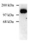 Discs Large MAGUK Scaffold Protein 1 antibody, GTX82842, GeneTex, Western Blot image 