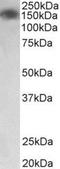 Myosin Light Chain Kinase 2 antibody, NBP2-11574, Novus Biologicals, Western Blot image 