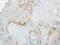 G Protein-Coupled Receptor Kinase 2 antibody, PA5-28609, Invitrogen Antibodies, Immunohistochemistry paraffin image 