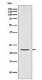PYD And CARD Domain Containing antibody, M00362, Boster Biological Technology, Western Blot image 
