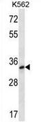 Testis Specific Protein Y-Linked 3 antibody, AP54385PU-N, Origene, Western Blot image 