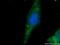 GEM Interacting Protein antibody, 25917-1-AP, Proteintech Group, Immunofluorescence image 