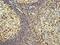MUM1 antibody, ab133590, Abcam, Immunohistochemistry paraffin image 