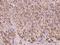 FYVE, RhoGEF And PH Domain Containing 6 antibody, 204776-T08, Sino Biological, Immunohistochemistry paraffin image 