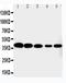 Cyclin Dependent Kinase 7 antibody, LS-C343914, Lifespan Biosciences, Western Blot image 