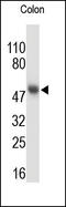 CASP8 And FADD Like Apoptosis Regulator antibody, 251855, Abbiotec, Western Blot image 