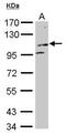 Kinesin Family Member 17 antibody, GTX116681, GeneTex, Western Blot image 