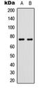 Tumor Protein P63 antibody, orb304645, Biorbyt, Western Blot image 