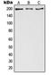 Zinc Finger CCCH-Type Containing 13 antibody, orb215069, Biorbyt, Western Blot image 