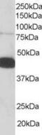 Pleckstrin antibody, PA5-18225, Invitrogen Antibodies, Western Blot image 