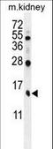 Tubulin Folding Cofactor A antibody, LS-C161736, Lifespan Biosciences, Western Blot image 