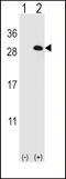 Eukaryotic Translation Initiation Factor 4E Family Member 2 antibody, 60-608, ProSci, Western Blot image 