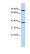 DEAH-Box Helicase 35 antibody, NBP1-57348, Novus Biologicals, Western Blot image 