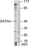 GATA Binding Protein 4 antibody, LS-C117900, Lifespan Biosciences, Western Blot image 