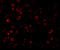 Interleukin 1 Receptor Associated Kinase 4 antibody, 3125, ProSci Inc, Immunofluorescence image 