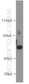 Glutaminyl-TRNA Amidotransferase Subunit QRSL1 antibody, 15926-1-AP, Proteintech Group, Western Blot image 