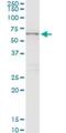 Cystinosin, Lysosomal Cystine Transporter antibody, H00001497-M09, Novus Biologicals, Western Blot image 