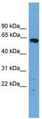 T-Box 22 antibody, TA329993, Origene, Western Blot image 