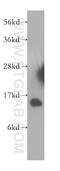 Mitogen-activated protein kinase scaffold protein 1 antibody, 11937-1-AP, Proteintech Group, Western Blot image 