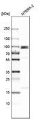 Microcephalin 1 antibody, PA5-52535, Invitrogen Antibodies, Western Blot image 