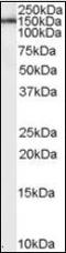 Leptin Receptor antibody, orb88639, Biorbyt, Western Blot image 