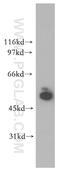 Serine/Threonine Kinase 33 antibody, 12857-1-AP, Proteintech Group, Western Blot image 