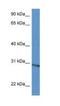 Ribosomal Protein L5 antibody, NBP1-74074, Novus Biologicals, Western Blot image 