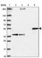 Cytochrome P450 Family 27 Subfamily A Member 1 antibody, PA5-63674, Invitrogen Antibodies, Western Blot image 