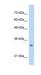 MRT4 Homolog, Ribosome Maturation Factor antibody, NBP1-53203, Novus Biologicals, Western Blot image 