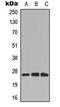 Cell Division Cycle Associated 4 antibody, LS-C358936, Lifespan Biosciences, Western Blot image 