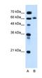 ITPRIP Like 1 antibody, orb325168, Biorbyt, Western Blot image 