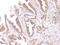 Tumor Necrosis Factor antibody, PA1079, Boster Biological Technology, Immunohistochemistry frozen image 