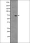 5'-Aminolevulinate Synthase 1 antibody, orb336496, Biorbyt, Western Blot image 