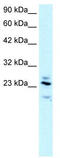 Regulator Of G Protein Signaling 20 antibody, TA334733, Origene, Western Blot image 