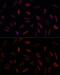 Frataxin antibody, GTX54036, GeneTex, Immunocytochemistry image 
