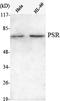 Jumonji Domain Containing 6, Arginine Demethylase And Lysine Hydroxylase antibody, STJ98543, St John