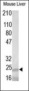 TGF beta antibody, 250876, Abbiotec, Western Blot image 