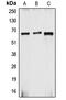 Cytochrome B-245 Beta Chain antibody, MBS820529, MyBioSource, Western Blot image 