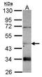 Carnosine Dipeptidase 2 antibody, GTX116375, GeneTex, Western Blot image 