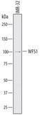 Wolframin ER Transmembrane Glycoprotein antibody, AF7417, R&D Systems, Western Blot image 