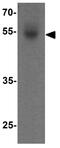 Forkhead Box A2 antibody, GTX31875, GeneTex, Western Blot image 