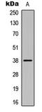 Casein Kinase 1 Alpha 1 antibody, LS-C358959, Lifespan Biosciences, Western Blot image 