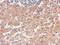 Alanyl-TRNA Synthetase antibody, GTX112477, GeneTex, Immunohistochemistry paraffin image 