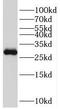 TCF3 Fusion Partner antibody, FNab08635, FineTest, Western Blot image 