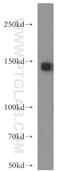 Synaptic Ras GTPase Activating Protein 1 antibody, 19739-1-AP, Proteintech Group, Western Blot image 