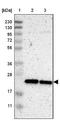 Solute Carrier Family 25 Member 48 antibody, NBP1-81893, Novus Biologicals, Western Blot image 